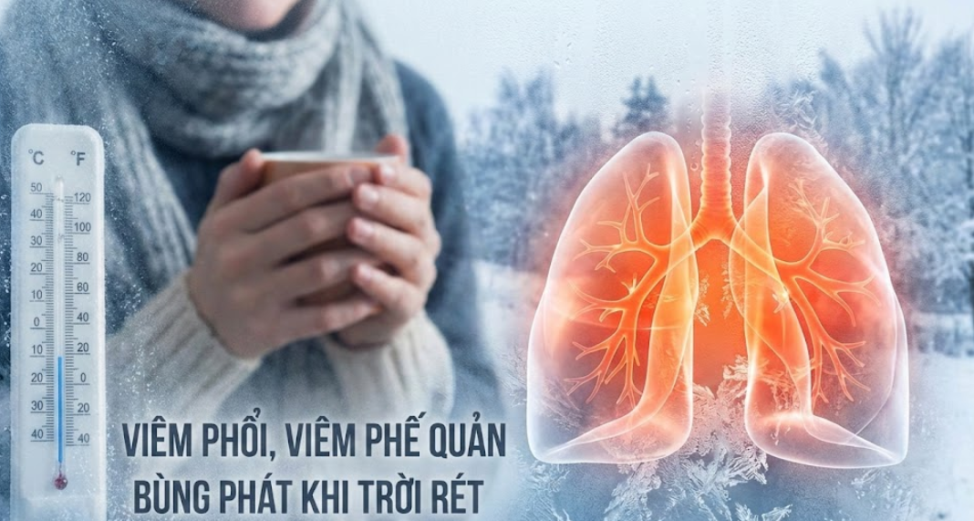 Viêm phổi, viêm phế quản bùng phát mạnh khi trời chuyển rét